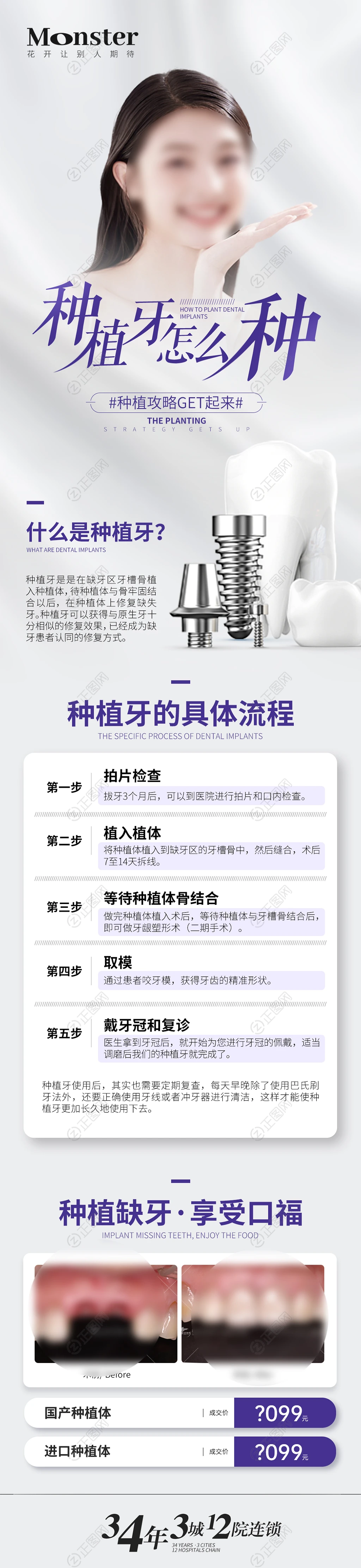 种植牙介绍微信长图 种植牙介绍微信长图